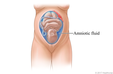 Baby in uterus, surrounded by amniotic fluid