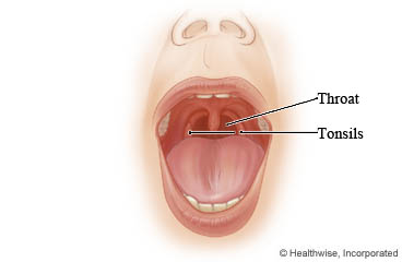 Picture of the throat and tonsils