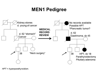 Pedigree showing some of the features of a family with a deleterious MEN1 mutation across four generations, including transmission occurring through paternal lineage. The unaffected male proband is shown as having an affected sister (self-report of neck surgery confirmed upon review of medical records to be hyperparathyroidism diagnosed at age 18 y, parathyroidectomy, and pituitary adenoma), father (self-report of stomach cancer confirmed upon review of medical records to be gastrinoma diagnosed at age 45 y), and paternal grandmother (suspected hyperparathyroidism and/or pancreatic tumor).