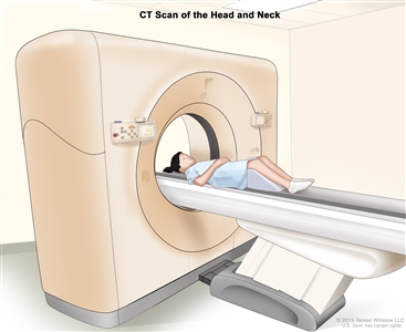 Computed tomography (CT) scan of the head and neck; drawing shows a child lying on a table that slides through the CT scanner, which takes a series of detailed x-ray pictures of the inside of the head and neck.