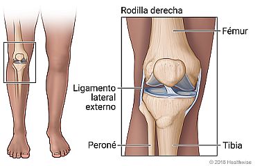 Vista interna de la rodilla donde se muestra el ligamento lateral externo, el ligamento lateral interno, y el fémur, el peroné y la tibia