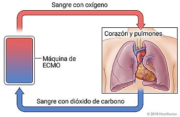 Diagrama de sangre con dióxido de carbono abandonando el cuerpo, pasando por la máquina de ECMO y regresando al cuerpo oxigenada nuevamente