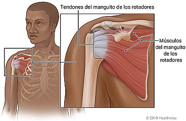 Manguito de los rotadores alrededor de la parte superior del hueso del brazo en el hombro, con primer plano de los tendones y músculos del manguito de los rotadores