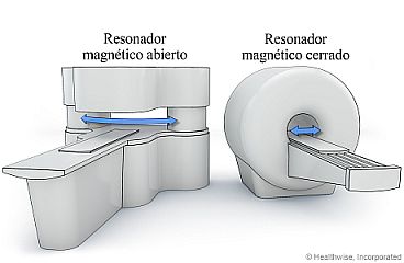 Resonador magnético abierto y cerrado