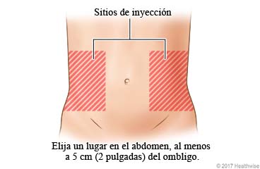 Elija un lugar en el abdomen, al menos a 2 pulgadas del ombligo.