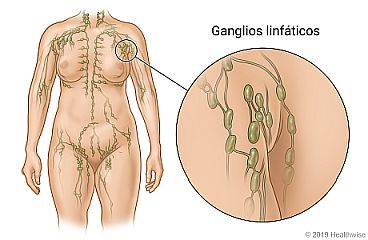 Ubicación de los ganglios linfáticos en todo el cuerpo, con detalle de los ganglios linfáticos cerca de la axila