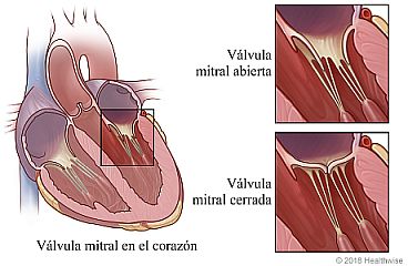 Vista del interior del corazón que muestra la ubicación de la válvula mitral entre dos cavidades cardíacas, con detalle de la válvula abierta y la válvula cerrada