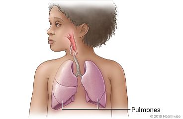 Aparato respiratorio de un niño, que incluye los pulmones y las vías respiratorias a los pulmones.