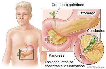 Páncreas detrás del estómago en el abdomen de un niño, con detalles del conducto colédoco y del conducto pancreático que se conectan a los intestinos.