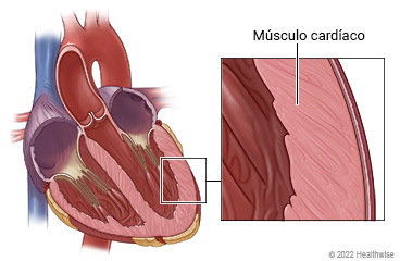 Sección transversal del corazón, con primer plano del músculo cardíaco que forma la pared del corazón.