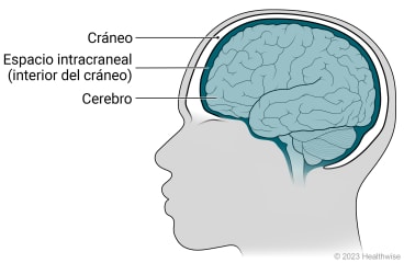 Vista lateral de la cabeza de una persona, mostrando el cráneo que rodea el cerebro en el espacio intracraneal.