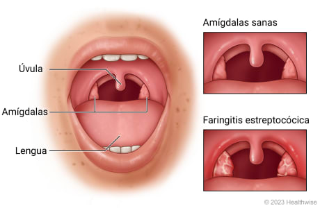 Boca abierta, donde se muestra la garganta, las amígdalas, la lengua y los dientes.