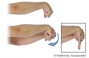 Imagen del estiramiento del extensor de la muñeca