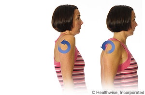 Imagen de cómo hacer la rotación de hombros
