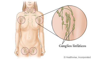 Ganglios linfáticos en todo el cuerpo