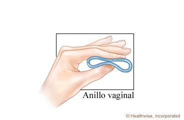 Imagen del anillo vaginal