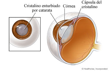 Una catarata