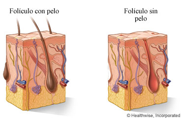 Folículos pilosos con y sin pelo