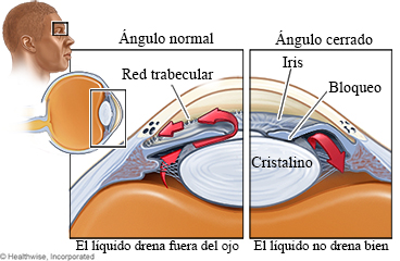 Estructuras afectadas por el glaucoma de ángulo cerrado