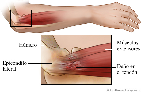 Anatomía del codo de tenista: Vista lateral