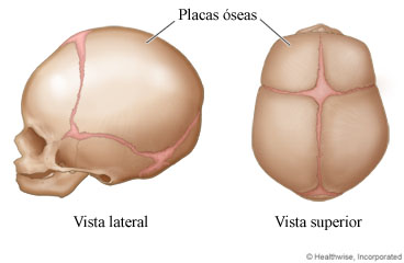Placas óseas en el cráneo de un recién nacido