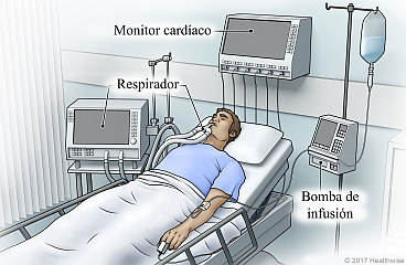 Equipo de UCI que incluye respirador, monitor cardíaco y bomba de medicamentos con i.v. conectada al paciente.