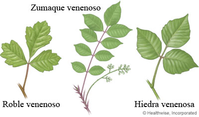 Imagen de la hiedra, el roble y el zumaque venenosos