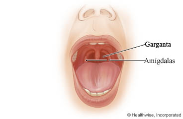 Imagen de la garganta y las amígdalas
