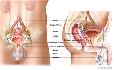 Anatomía del sistema reproductor y el sistema urinario masculino; el dibujo muestra vistas frontales y laterales de los uréteres, los ganglios linfáticos, la vejiga, el recto, la glándula prostática, el conducto deferente, la uretra, el pene y los testículos, la vesícula seminal, y el conducto eyaculatorio.