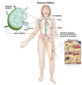 Sistema linfático. Dibujo de una mujer adulta en el que se observan los vasos y ganglios linfáticos del cuerpo y otros órganos del sistema linfático, como las amígdalas, el timo, el bazo y la médula ósea, así como el tejido linfoide asociado a mucosas que se encuentra en el intestino delgado. En la parte superior izquierda, se observa una ampliación de la estructura interna de un ganglio linfático con una arteria, una vena y vasos linfáticos con flechas que señalan la forma en que la linfa (líquido claro) entra y sale del ganglio linfático. En la parte inferior derecha, en una ampliación del hueso del muslo, se observa la médula ósea con células sanguíneas.