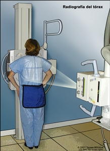 Radiografía del tórax. En el dibujo se muestra a una paciente de pie con la espalda hacia la máquina de rayos-X. Los rayos X pasan a través del cuerpo de la paciente y se plasman en una película o computadora; de esta manera, se toman imágenes de las estructuras y los órganos en el interior del tórax.