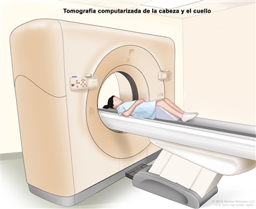 En este dibujo se observa una niña acostada sobre una camilla que se desliza a través del escáner de TC, con el que se toma una serie de imágenes radiográficas detalladas del interior de la cabeza y el cuello.