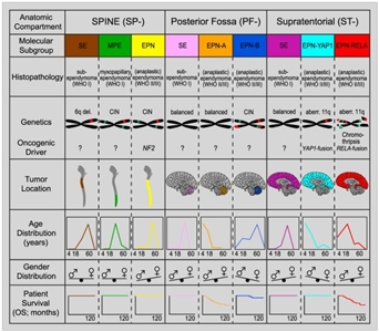 Gráfico en el que se muestran las características moleculares y clínicas clave de subgrupos de tumores ependimarios.