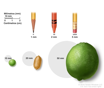 En la imagen se muestran objetos comunes de distintos tamaños en milímetros (mm): la punta fina de un lápiz (1 mm), la punta de un crayón nuevo (2 mm), la goma de borrar de un lápiz (5 mm), una arveja (10 mm), un maní (20 mm) y una lima (50 mm). También se observa una regla de dos centímetros (cm) que muestra que 10 mm equivalen a 1 cm.