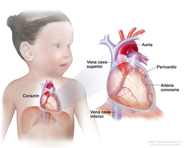 Anatomía del corazón. Dibujo de una niña donde se observa la ubicación del corazón en su cuerpo y en una ampliación se señala la aorta, la vena cava superior, el pericardio, una arteria coronaria y la vena cava inferior.