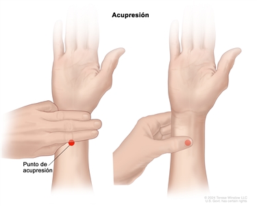 Acupresión. Dibujo donde se muestra la ubicación de un punto de acupresión en la muñeca y la manera de encontrarlo. En el lado izquierdo se observa el antebrazo de una persona adulta con la palma de la mano hacía arriba. También se observan tres dedos de la otra mano tocando la muñeca por debajo del pliegue de la palma de la mano y se señala con un círculo rojo un punto de acupresión en la muñeca justo debajo de los tres dedos. En el lado derecho se observa el antebrazo de una persona adulta con la palma de la mano hacia arriba y el pulgar de la otra mano presionando el punto de acupresión señalado con un círculo rojo. Se usa el pulgar para presionar este punto con firmeza en forma de círculos.