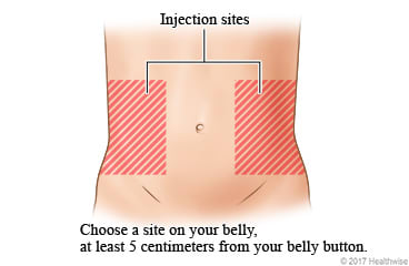 Injection sites, to either side and at least 2 inches from belly button.