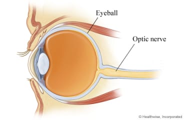 Eyeball and optic nerve