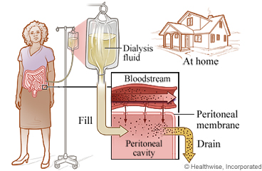 Peritoneal dialysis