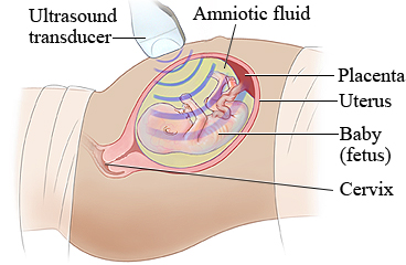 Ultrasound of a pregnant woman's belly