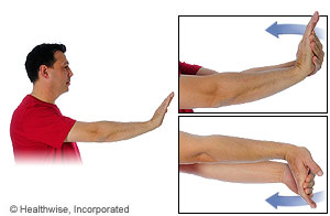 Picture showing how to do wrist flexor stretch Picture showing how to do wrist flexor stretch