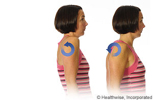 Picture of shoulder rolls exercise Picture of shoulder rolls exercise