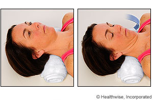 Picture of chin tuck exercise Picture of chin tuck exercise