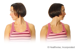 Picture of how to do neck rotation exercise Picture of how to do neck rotation exercise