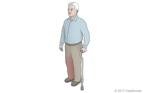 Holding a cane. Holding a cane.