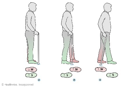 Walking with a cane. Walking with a cane.