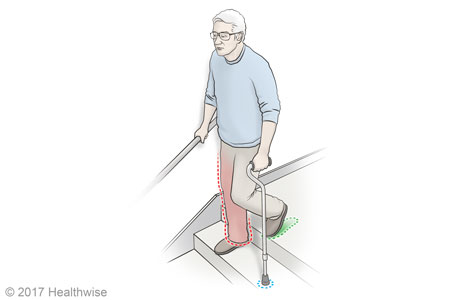 Going down stairs with a cane. Going down stairs with a cane.