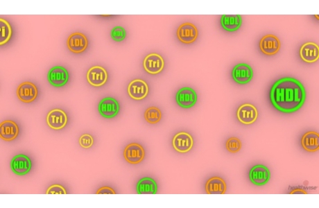 Cholesterol Test: Understanding the Test