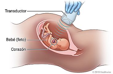 Transductor de ecocardiografía sobre el abdomen de una mujer embarazada, con una sección transversal del útero que muestra ondas sonoras que miden el corazón del bebé.