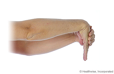 Imagen que muestra cómo se hace el estiramiento del extensor de la muñeca